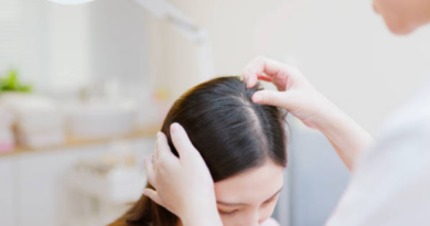 saç derisi hastalıkları