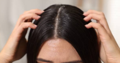 Saç Derisinde Kabuklanma Neden Olur? Nasıl Geçer? Saç Derisinde Kabuklanma