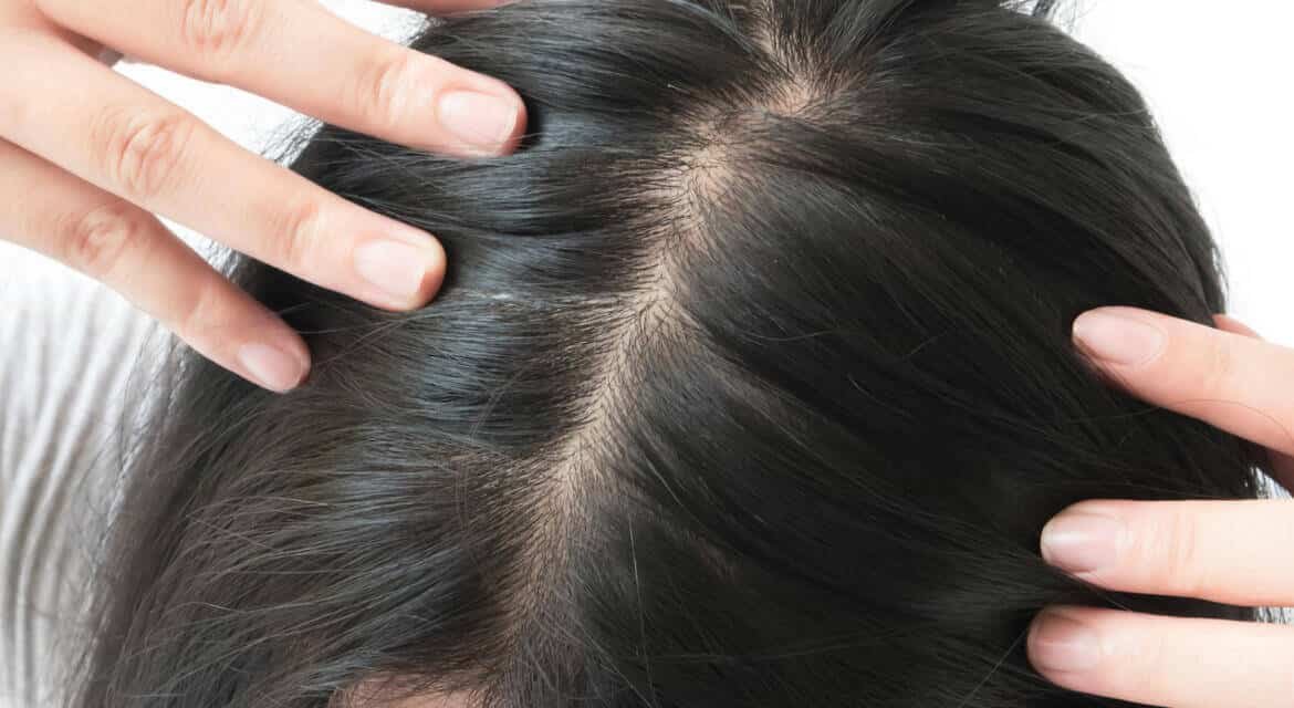 Saç Dökülmesi Neden Olur?